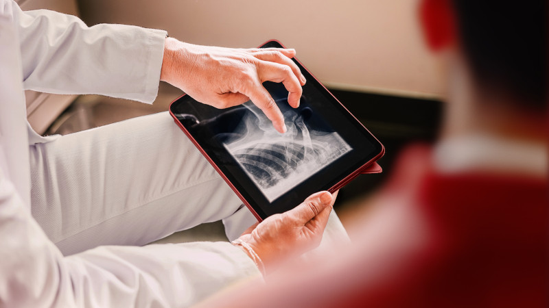 A man in a white coat examines an X-ray image displayed on his tablet, indicating a medical evaluation.